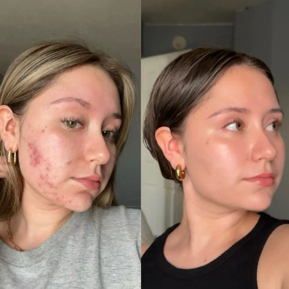 Glass Glow Skincare Set | 8-Step Hydrating & Radiance Routine - Image 2